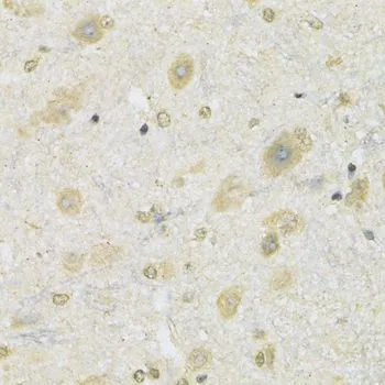IHC-P analysis of mouse spinal cord tissue using GTX65995 SLC2A13 antibody. Dilution : 1:100