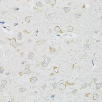 IHC-P analysis of rat brain tissue using GTX65995 SLC2A13 antibody. Dilution : 1:100