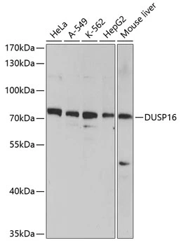 WB analysis of various sample lysates using GTX66001 DUSP16 antibody. Dilution : 1:1000 Loading : 25microg per lane WB analysis of various sample lysates using GTX66001 DUSP16 antibody. Dilution : 1:1000 Loading : 25microg per lane