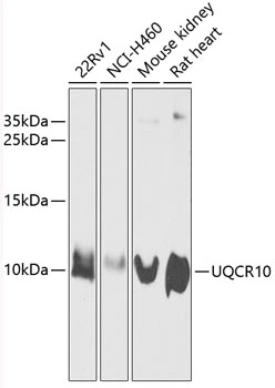 WB analysis of various sample lysates using GTX66006 UQCR10 antibody. The signal was developed with ECL plus-Enhanced. Dilution : 1:1000 Loading : 25microg per lane WB analysis of various sample lysates using GTX66006 UQCR10 antibody. The signal was developed with ECL plus-Enhanced. Dilution : 1:1000 Loading : 25microg per lane