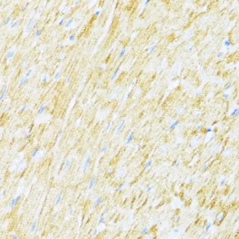 IHC-P analysis of rat heart tissue using GTX66006 UQCR10 antibody. Dilution : 1:100