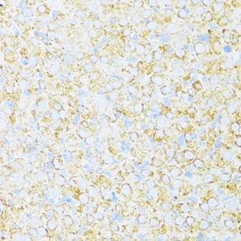 IHC-P analysis of rat ovary tissue using GTX66006 UQCR10 antibody. Dilution : 1:100