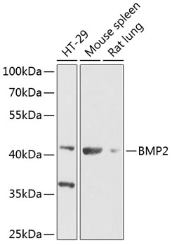 WB analysis of various sample lysates using GTX66008 BMP2 antibody. The signal was developed with ECL plus-Enhanced. Dilution : 1:1000 Loading : 25microg per lane WB analysis of various sample lysates using GTX66008 BMP2 antibody. The signal was developed with ECL plus-Enhanced. Dilution : 1:1000 Loading : 25microg per lane