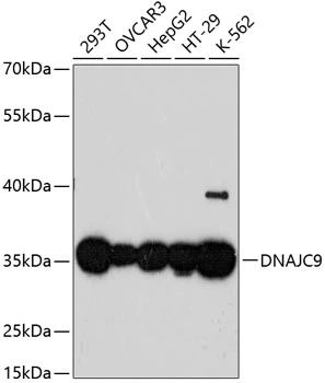 WB analysis of various sample lysates using GTX66009 DNAJC9 antibody. Dilution : 1:3000 Loading : 25microg per lane WB analysis of various sample lysates using GTX66009 DNAJC9 antibody. Dilution : 1:3000 Loading : 25microg per lane