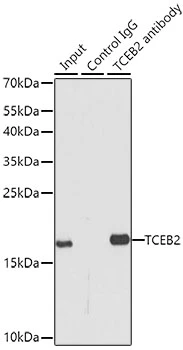 IP analysis of MCF7 cell lysate using GTX66010 Elongin B antibody. Antibody amount : 3microg / 150microg lysate Dilution : 1:500 IP analysis of MCF7 cell lysate using GTX66010 Elongin B antibody. Antibody amount : 3microg / 150microg lysate Dilution : 1:500