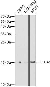 WB analysis of various sample lysates using GTX66010 Elongin B antibody. Dilution : 1:1000 Loading : 25microg per lane
