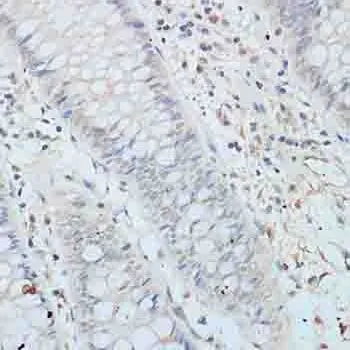 IHC-P analysis of human colon tissue using GTX66010 Elongin B antibody. Dilution : 1:100