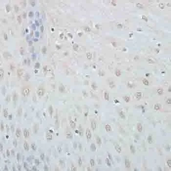 IHC-P analysis of human esophagus tissue using GTX66010 Elongin B antibody. Dilution : 1:100