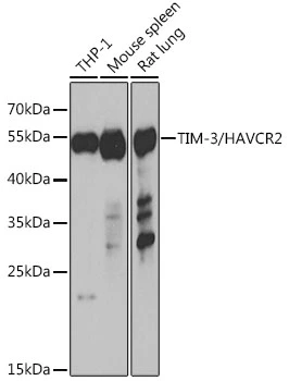 WB analysis of various sample lysates using GTX66011 TIM-3 antibody. Dilution : 1:1000 Loading : 25microg per lane