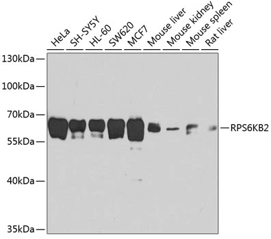 WB analysis of various sample lysates using GTX66013 p70 S6K beta antibody. Dilution : 1:1000 Loading : 25microg per lane