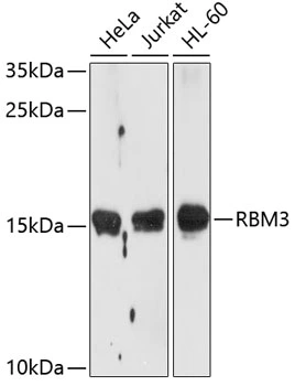 WB analysis of various sample lysates using GTX66019 RBM3 antibody. Dilution : 1:1000 Loading : 25microg per lane WB analysis of various sample lysates using GTX66019 RBM3 antibody. Dilution : 1:1000 Loading : 25microg per lane