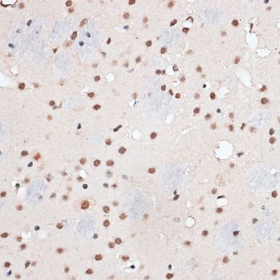 IHC-P analysis of mouse brain tissue using GTX66019 RBM3 antibody. Dilution : 1:100