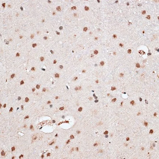 IHC-P analysis of rat brain tissue using GTX66019 RBM3 antibody. Dilution : 1:100