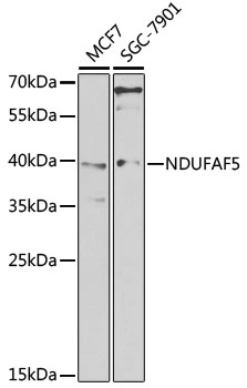 WB analysis of various sample lysates using GTX66023 C20orf7 antibody. Dilution : 1:1000 Loading : 25microg per lane