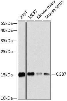 WB analysis of various sample lysates using GTX66027 hCG beta 7 antibody. Dilution : 1:1000 Loading : 25microg per lane