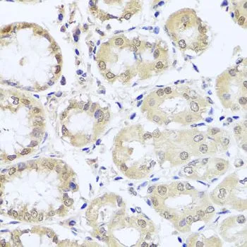 IHC-P analysis of human stomach tissue using GTX66027 hCG beta 7 antibody. Dilution : 1:100