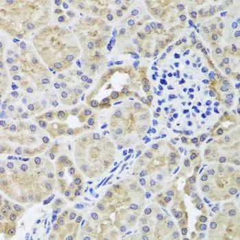 IHC-P analysis of mouse kidney tissue using GTX66027 hCG beta 7 antibody. Dilution : 1:100