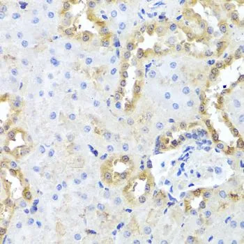 IHC-P analysis of rat kidney tissue using GTX66027 hCG beta 7 antibody. Dilution : 1:100