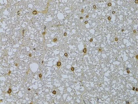 IHC-P analysis of rat spinal cord tissue using GTX66028 HDGFRP3 antibody. Dilution : 1:100