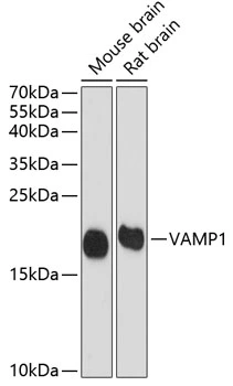 WB analysis of various sample lysates using GTX66029 VAMP1 antibody. Dilution : 1:1000 Loading : 25microg per lane