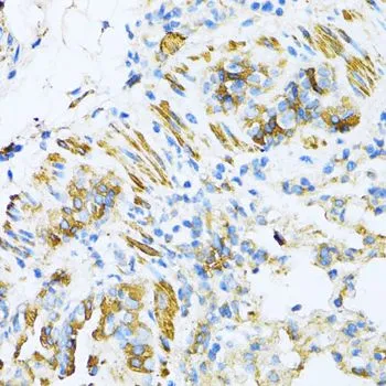 IHC-P analysis of mouse lung tissue using GTX66029 VAMP1 antibody. Dilution : 1:100