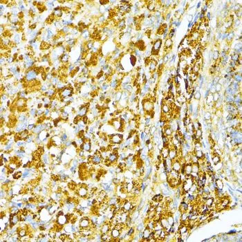 IHC-P analysis of rat ovary tissue using GTX66029 VAMP1 antibody. Dilution : 1:100