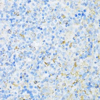 IHC-P analysis of rat spleen tissue using GTX66029 VAMP1 antibody. Dilution : 1:100