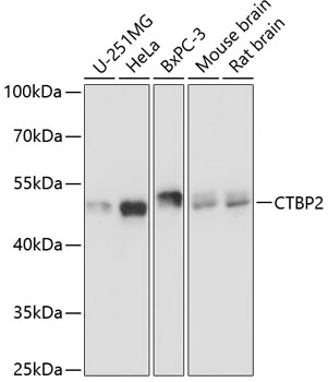 WB analysis of various sample lysates using GTX66034 CtBP2 antibody. Dilution : 1:3000 Loading : 25microg per lane WB analysis of various sample lysates using GTX66034 CtBP2 antibody. Dilution : 1:3000 Loading : 25microg per lane