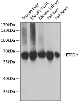 WB analysis of various sample lysates using GTX66035 ETFDH antibody. Dilution : 1:1000 Loading : 25microg per lane WB analysis of various sample lysates using GTX66035 ETFDH antibody. Dilution : 1:1000 Loading : 25microg per lane