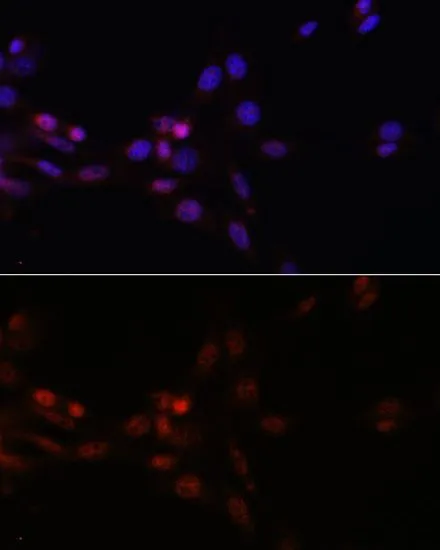 ICC/IF analysis of NIH/3T3 cells using GTX66040 SFRS3 antibody. Blue : DAPI Dilution : 1:100