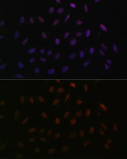 ICC/IF analysis of U2OS cells using GTX66040 SFRS3 antibody. Blue : DAPI Dilution : 1:100