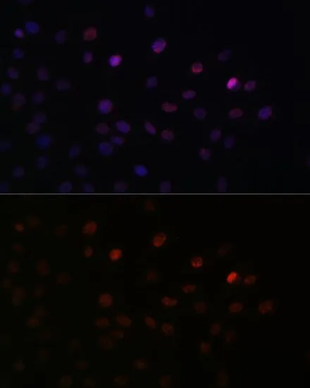 ICC/IF analysis of C6 cells using GTX66040 SFRS3 antibody. Blue : DAPI Dilution : 1:100