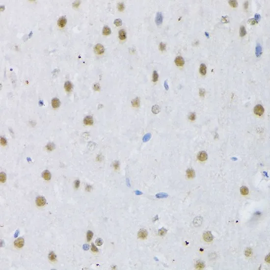 IHC-P analysis of rat brain tissue using GTX66040 SFRS3 antibody. Dilution : 1:100
