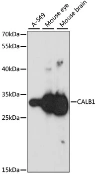WB analysis of various sample lysates using GTX66044 Calbindin antibody. Dilution : 1:1000 Loading : 25microg per lane WB analysis of various sample lysates using GTX66044 Calbindin antibody. Dilution : 1:1000 Loading : 25microg per lane