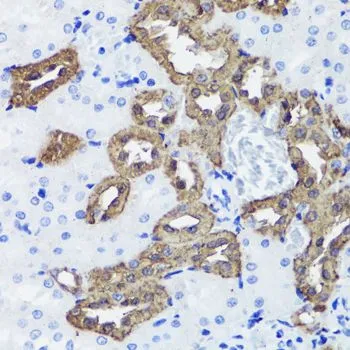 IHC-P analysis of rat kidney tissue using GTX66044 Calbindin antibody. Dilution : 1:100