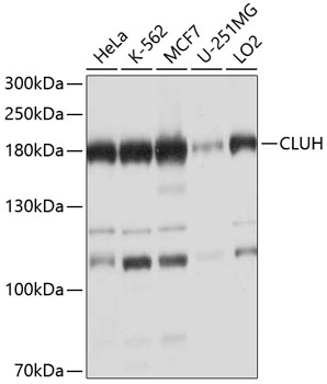 WB analysis of various sample lysates using GTX66049 CLUH antibody. Dilution : 1:1000 Loading : 25microg per lane WB analysis of various sample lysates using GTX66049 CLUH antibody. Dilution : 1:1000 Loading : 25microg per lane