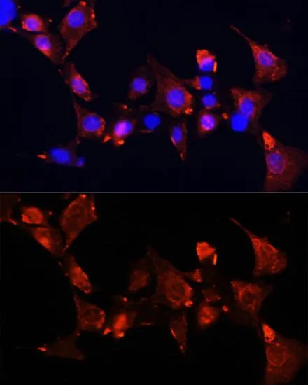 ICC/IF analysis of NIH/3T3 cells using GTX66049 CLUH antibody. Blue : DAPI Dilution : 1:100