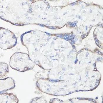 IHC-P analysis of human placenta tissue using GTX66049 CLUH antibody. Dilution : 1:100
