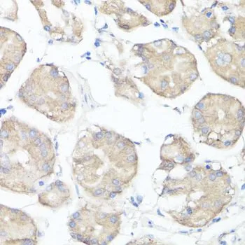 IHC-P analysis of human stomach tissue using GTX66049 CLUH antibody. Dilution : 1:100