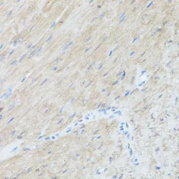IHC-P analysis of mouse heart tissue using GTX66049 CLUH antibody. Dilution : 1:100