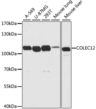 WB analysis of various sample lysates using GTX66059 COLEC12 antibody. Dilution : 1:2000 Loading : 25microg per lane WB analysis of various sample lysates using GTX66059 COLEC12 antibody. Dilution : 1:2000 Loading : 25microg per lane