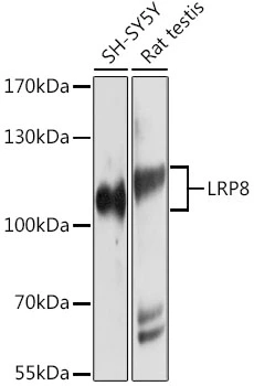 WB analysis of various sample lysates using GTX66061 ApoER2 antibody. Dilution : 1:1000 Loading : 25microg per lane WB analysis of various sample lysates using GTX66061 ApoER2 antibody. Dilution : 1:1000 Loading : 25microg per lane