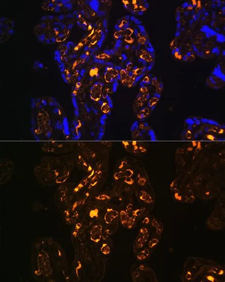 IHC-P analysis of human placenta tissue using GTX66061 ApoER2 antibody. Blue : DAPI Dilution : 1:100