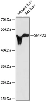 WB analysis of various sample lysates using GTX66078 SMPD2 antibody. Dilution : 1:3000 Loading : 25microg per lane WB analysis of various sample lysates using GTX66078 SMPD2 antibody. Dilution : 1:3000 Loading : 25microg per lane
