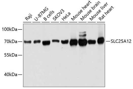 WB analysis of various sample lysates using GTX66079 ARALAR antibody. Dilution : 1:3000 Loading : 25microg per lane WB analysis of various sample lysates using GTX66079 ARALAR antibody. Dilution : 1:3000 Loading : 25microg per lane