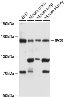WB analysis of various sample lysates using GTX66092 Importin 9 antibody. Dilution : 1:3000 Loading : 25microg per lane WB analysis of various sample lysates using GTX66092 Importin 9 antibody. Dilution : 1:3000 Loading : 25microg per lane