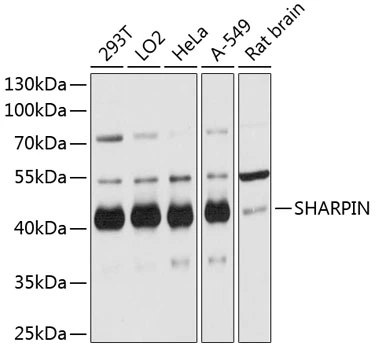 WB analysis of various sample lysates using GTX66093 SHARPIN antibody. Dilution : 1:3000 Loading : 25microg per lane WB analysis of various sample lysates using GTX66093 SHARPIN antibody. Dilution : 1:3000 Loading : 25microg per lane