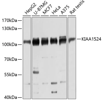 WB analysis of various sample lysates using GTX66094 CIP2A antibody. Dilution : 1:3000 Loading : 25microg per lane WB analysis of various sample lysates using GTX66094 CIP2A antibody. Dilution : 1:3000 Loading : 25microg per lane