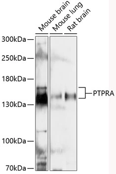 WB analysis of various sample lysates using GTX66097 PTPRA antibody. Dilution : 1:3000 Loading : 25microg per lane WB analysis of various sample lysates using GTX66097 PTPRA antibody. Dilution : 1:3000 Loading : 25microg per lane