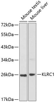 WB analysis of various sample lysates using GTX66098 NKG2A antibody. The signal was developed with ECL plus-Enhanced. Dilution : 1:1000 Loading : 25microg per lane WB analysis of various sample lysates using GTX66098 NKG2A antibody. The signal was developed with ECL plus-Enhanced. Dilution : 1:1000 Loading : 25microg per lane